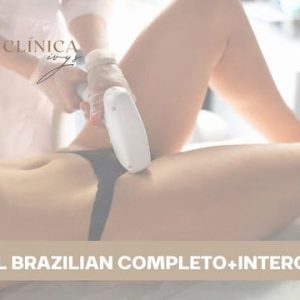 Pack Depilación Full Brazilian Rebaje Completo+Interglúteo (6 sesiones)