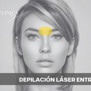 Depilación Láser Entrecejo