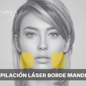 Depilación Láser Borde Mandibular