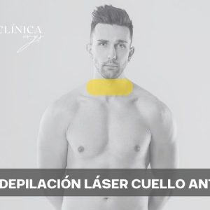 Depilación Láser Cuello Anterior