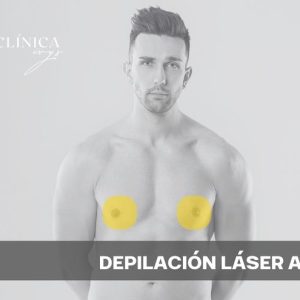 Depilación Láser Areola